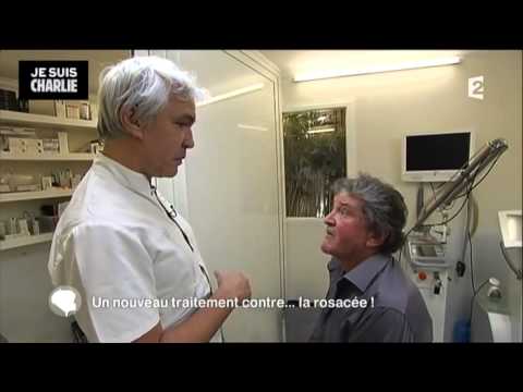 Un nouveau traitement contre…la rosacée !